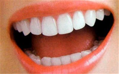 سیگاری ها از چه روشی برای سفیدی دندان استفاده کنند؟
