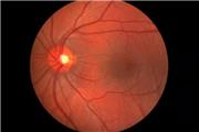 نتایج امیدوارکننده یک روش جدید ژن‌درمانی برای بازگرداندن بینایی